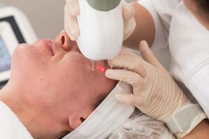 LaserTreatment